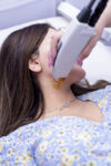 Laser Hair Removal Upper Lips