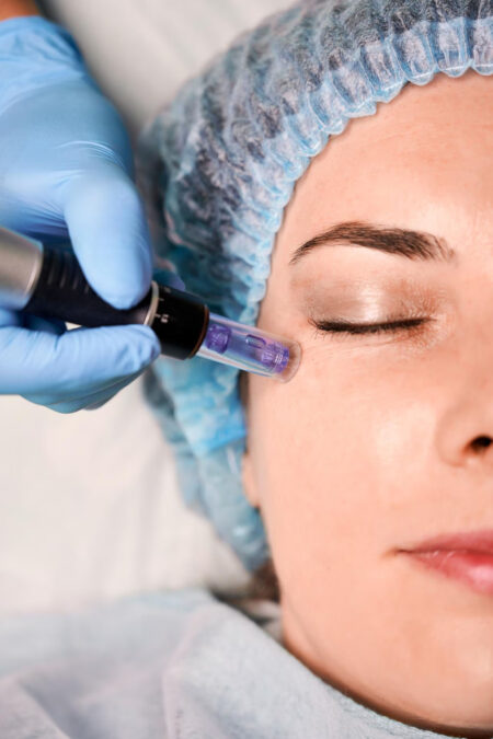 Mesotherapy Facial Treatment