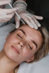 Whitening Injections Treatment