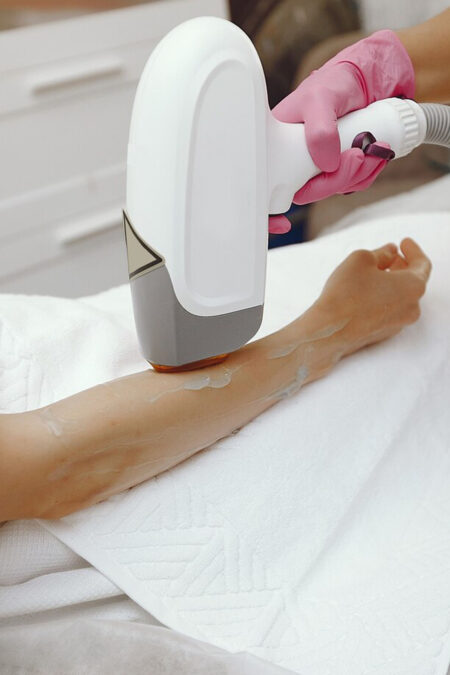 Laser Hair Removal Half Arms