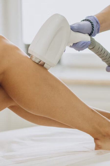 Laser Hair Removal Half Legs