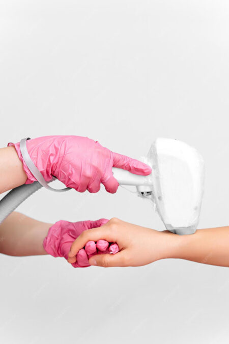 Laser Hair Removal Hand & Fingers