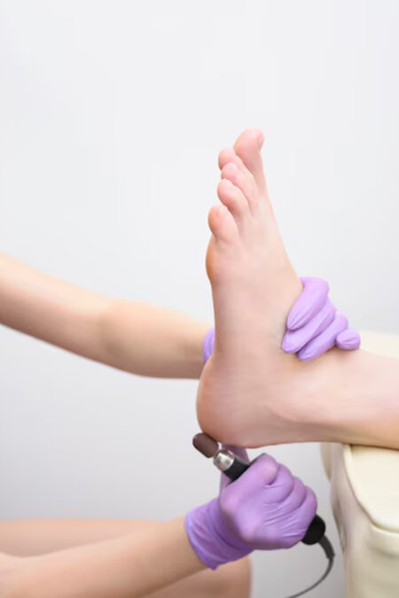 Laser Hair Removal Toe